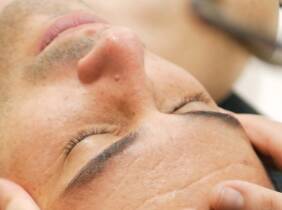 Limpieza facial para hombres en las clínicas Láser Fusión Alicante