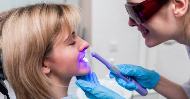 Limpieza bucal con opción a blanqueamiento led