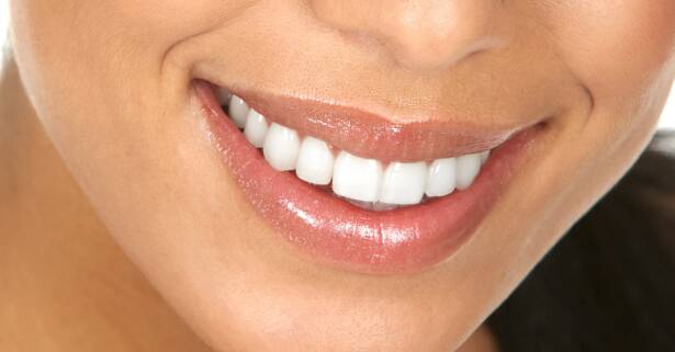 Blanqueamiento led y limpieza bucal en Clinica dental Marcelo Usera