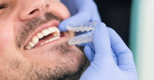 Descuento de 400 € en ortodoncia invisible en H2G Studio Dental