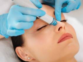 Hydrafacial con peeling natural