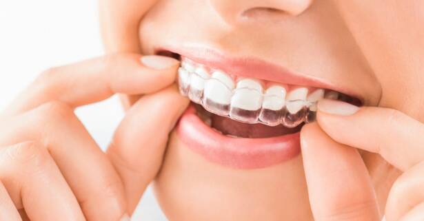 Descuento en tratamiento de Invisalign en Ortodoncia del Campillo