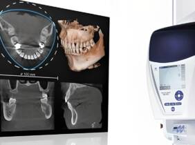 Tomografía axial computarizada (TAC) en Clínica Citadental Orense