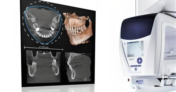 Tomografía axial computarizada (TAC) en Clínica Citadental Orense