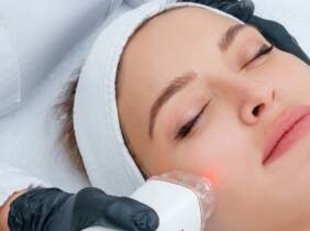 1 a 3 sesiones de radiofrecuencia facial en Beauty Clinic