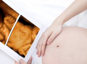 ❤ ¡Conoce a tu bebé en Ecox 4D Prenatal Barcelona!