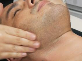 Limpieza facial para hombres en las clínicas Láser Fusión Carranza