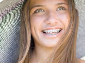 Ortodoncia con brackets a elegir