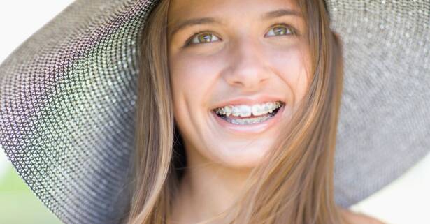 Ortodoncia con brackets a elegir