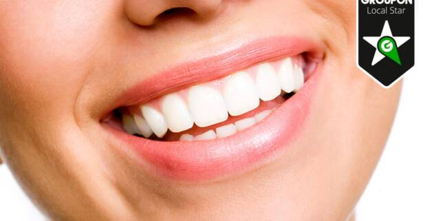 Limpieza y blanqueamiento dental