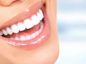 Blanqueamiento dental - en consu