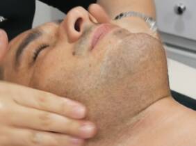 Limpieza facial para hombres en las clínicas Laser Fusion Raimundo