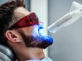 2 sesiones de blanqueamiento dental led en Clínica Dental La Paz