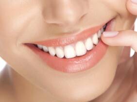 Higiene y blanqueamiento dental