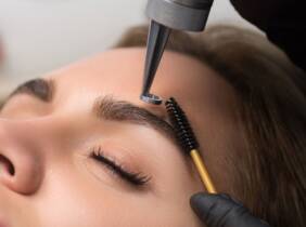 Eliminación de microblading en cejas en Estética 360