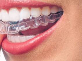 Descuento en Invisalign