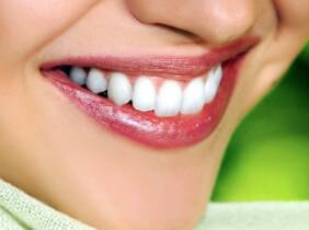 Blanqueamiento dental - En consu